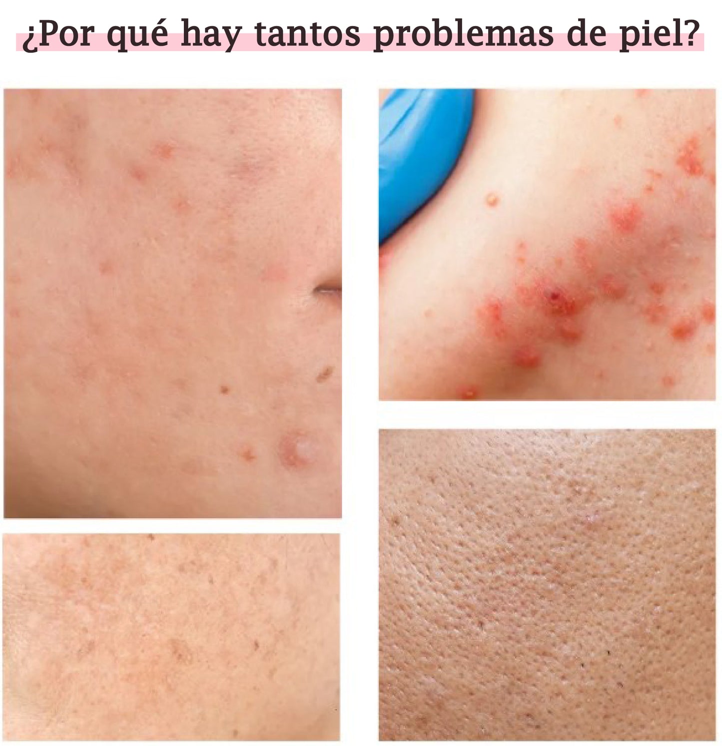 Reafirma tu piel en 7 días con LuxCare® + mascarilla de té GRATIS