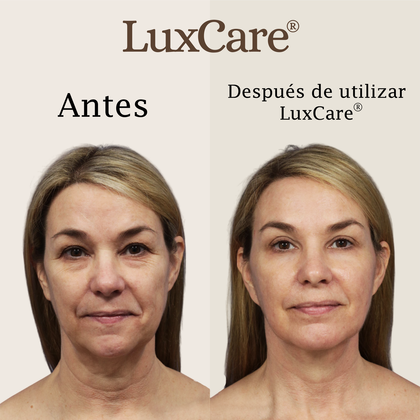 Reafirma tu piel en 7 días con LuxCare® + Serum Vitamina C GRATIS